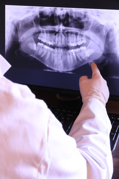 Best Emergency Dentist for Knocked-Out Tooth in Ruidoso Downs, NM